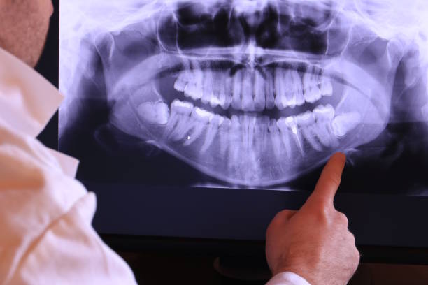 Best Emergency Dentist for Lost Fillings or Crowns in Hildebran, NC